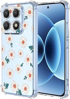 XINYEXIN Mobile Phone Case for Xiaomi 17 5G…